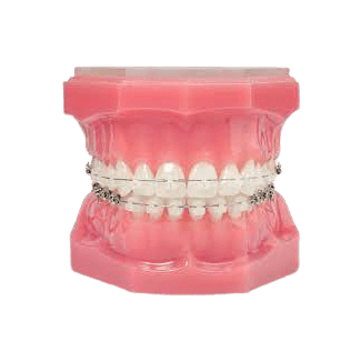 Orthodontic Accessories image