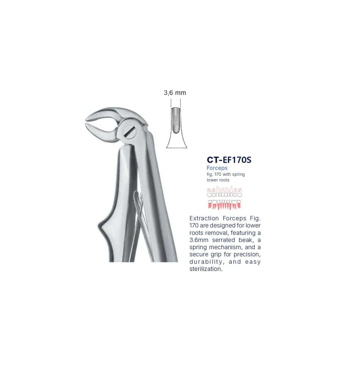 Dental Extraction Forceps 170, Standard Handle