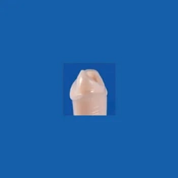 A21AN-UL18C, Pre-Prepared Tooth #21 (Post)
