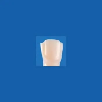 A25AN-UR19J, Pre-Prepared Tooth #11 (Veneer)