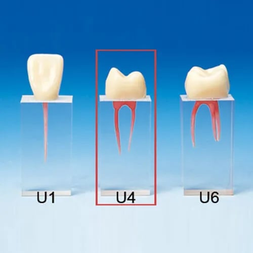 S3-U4, Root Canal Model